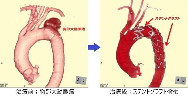 心臓血管外科｜診療科・部門｜白十字病院｜社会医療法人財団白十字会
